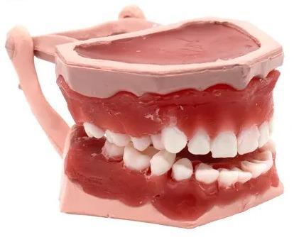 TIPODONTO DE CERA CON MALOCLUSION (NACIONAL)