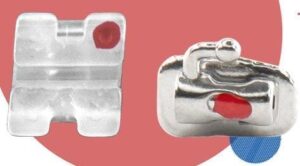 JUEGO DE BRACKETS GLINT CERAMICOS ROTH .022 C/G 345 C/TUBOS P/6